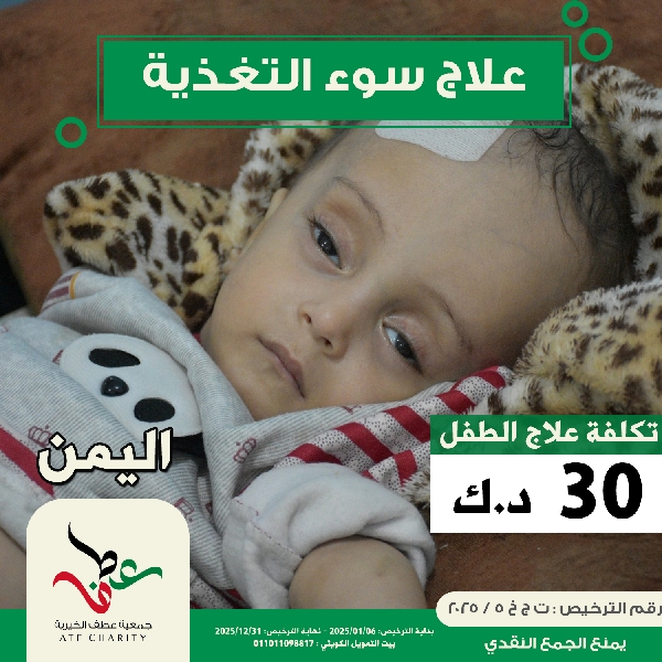 صورة علاج سوء التغذية